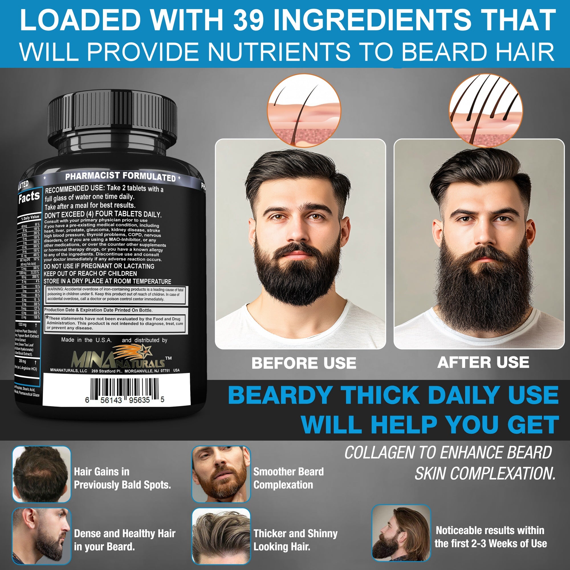 BEARDY THICK  Beard Growth Supplement. B7 - Biotin 10000 mcg, Keratin, Collagen, Silica, and 36 More. Regrow Thicker, Stronger Facial Hair Regrowth Treatment. 60 Tablets